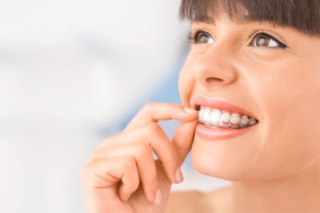Kto może korzystać z nakładek ortodontycznych?