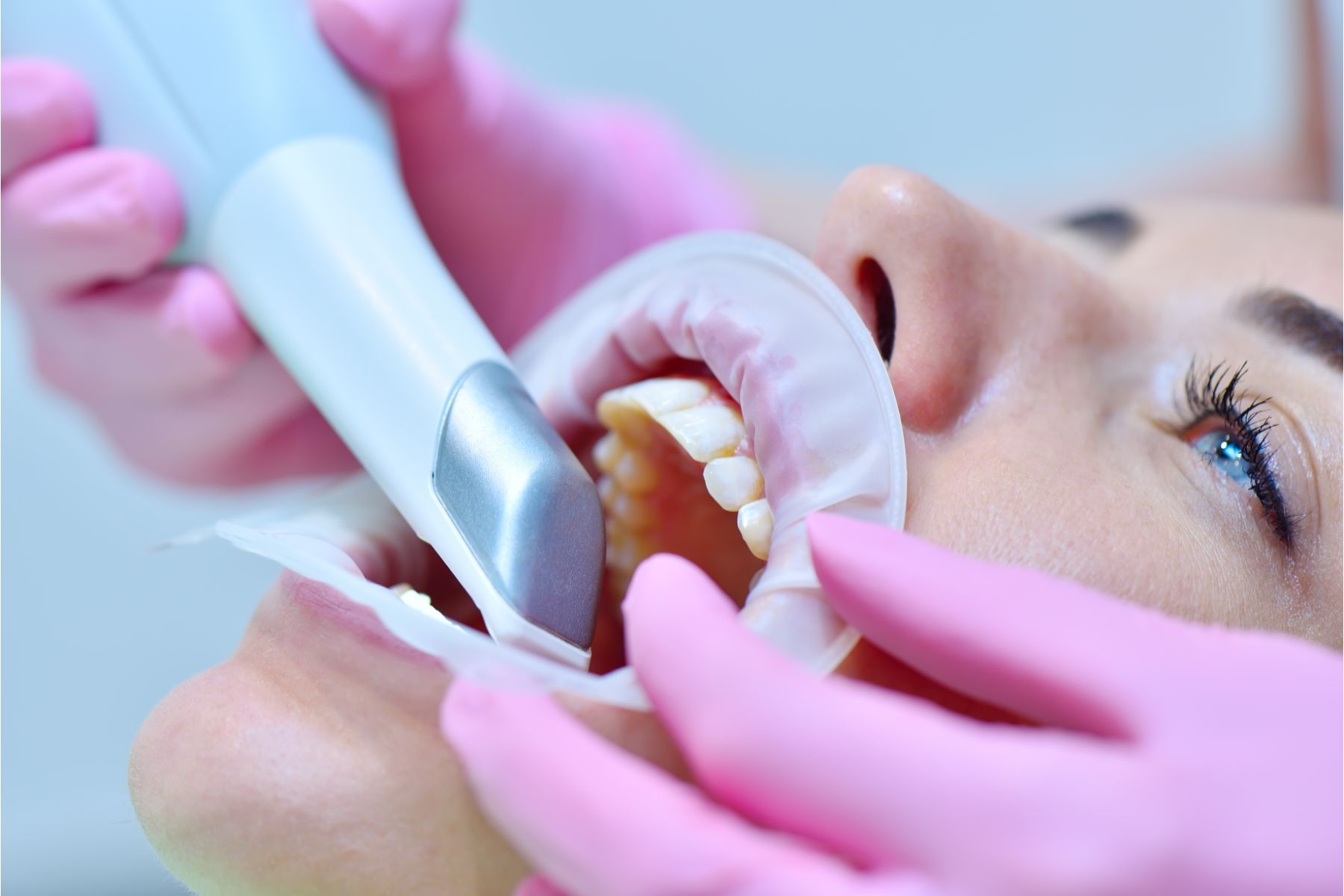 Skan 3D, czyli nowoczesność i wygoda w ortodoncji