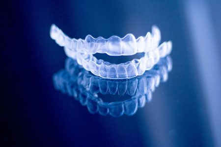 informacje na temat nakładek ortodontycznych